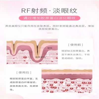 淡眼紋眼部射頻美容儀按摩儀導(dǎo)入導(dǎo)出EMS美眼儀方案開發(fā)方案設(shè)計(jì)